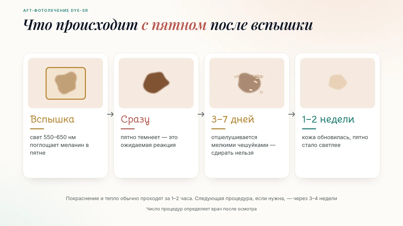 Что происходит с пятном после AFT-фотолечения: вспышка 550–650 нм, пятно темнеет сразу, отшелушивается за 3–7 дней, через 1–2 недели кожа обновилась и пятно светлее